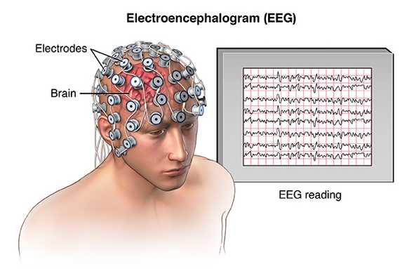 eeg ile ilgili gÃ¶rsel sonucu